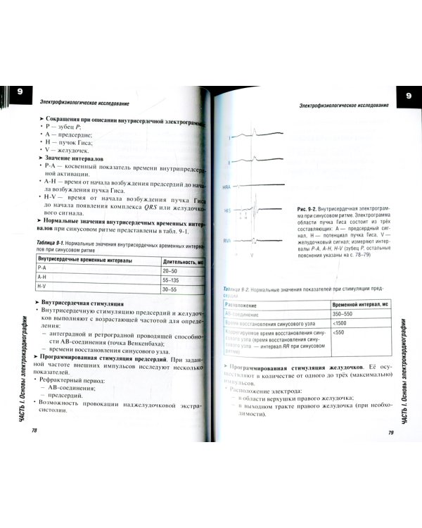 ЭКГ. Карманный справочник. 2-е изд