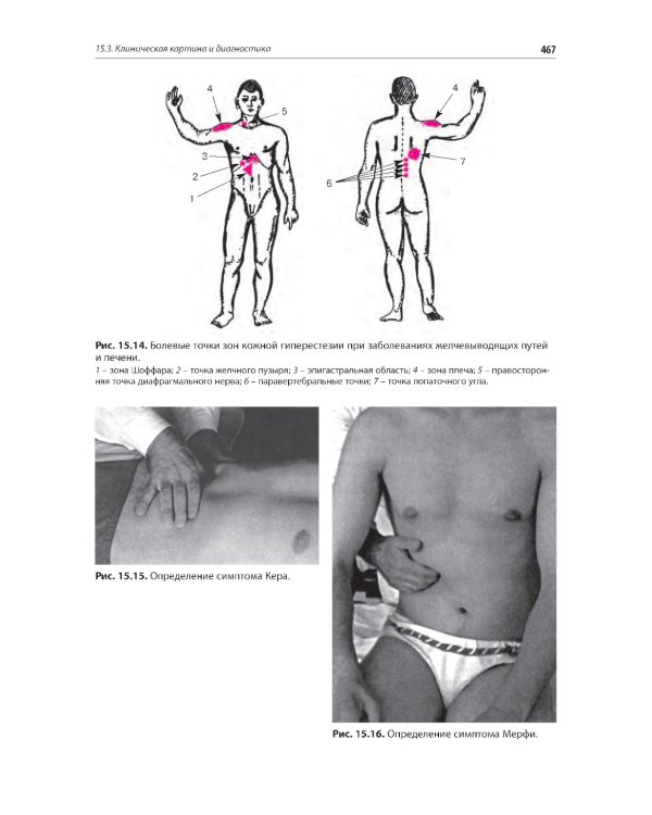 Внутренние болезни. Печень, желчевыводящие пути, поджелудочная железа: Учебное пособие. 5-е изд