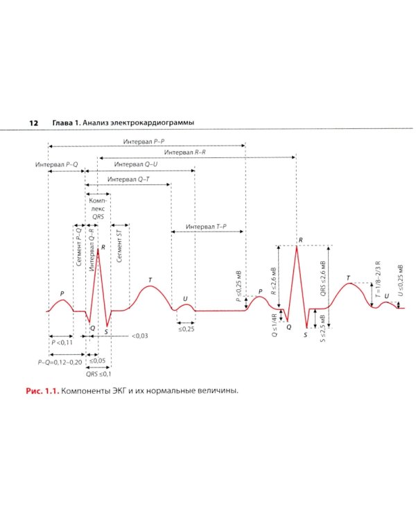 Электрокардиограмма: основы дифференциальной диагностики. 2-е изд