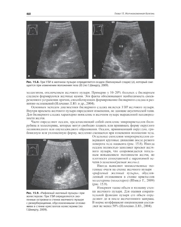 Внутренние болезни. Печень, желчевыводящие пути, поджелудочная железа: Учебное пособие. 5-е изд