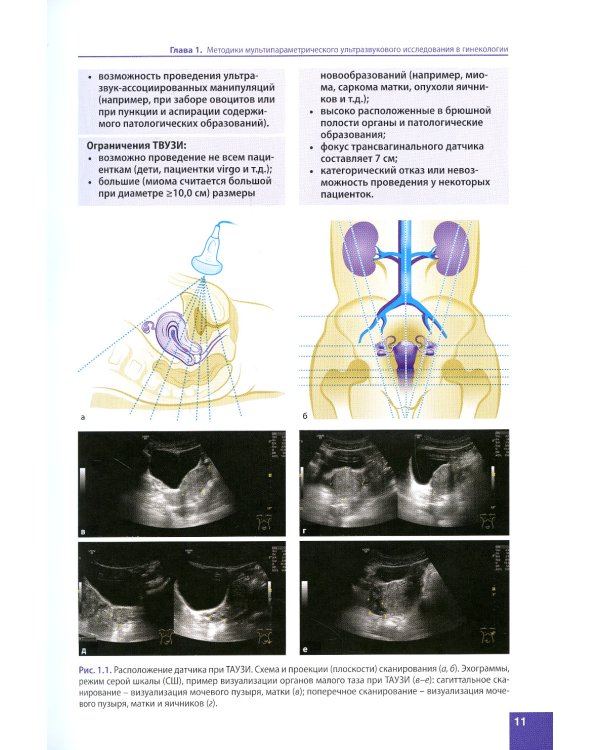 Ультразвуковая диагностика заболеваний органов малого таза