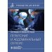 Перитонит и абдоминальный сепсис: руководство для врачей