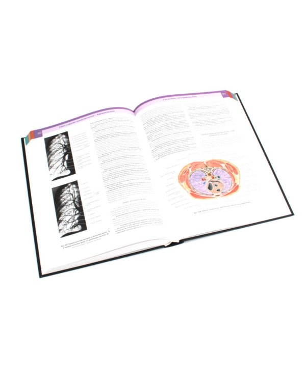 Атлас анатомии человека: В 3 т. Комплект