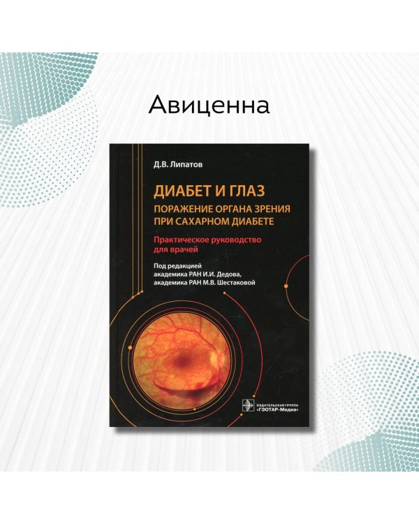 Диабет и глаз. Поражение органа зрения при сахарном диабете