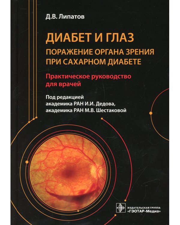 Диабет и глаз. Поражение органа зрения при сахарном диабете: практическое руководство для врачей