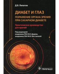 Диабет и глаз. Поражение органа зрения при сахарном диабете: практическое руководство для врачей