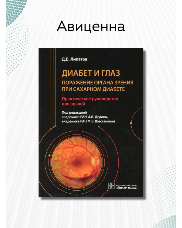 Диабет и глаз. Поражение органа зрения при сахарном диабете