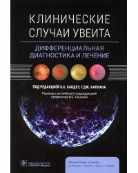 Клинические случаи увеита. Дифференциальная диагностика и лечение