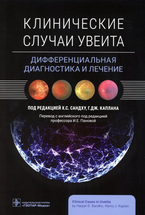 Клинические случаи увеита. Дифференциальная диагностика и лечение Клинические случаи увеита. Дифференциальная диагностика и лечение