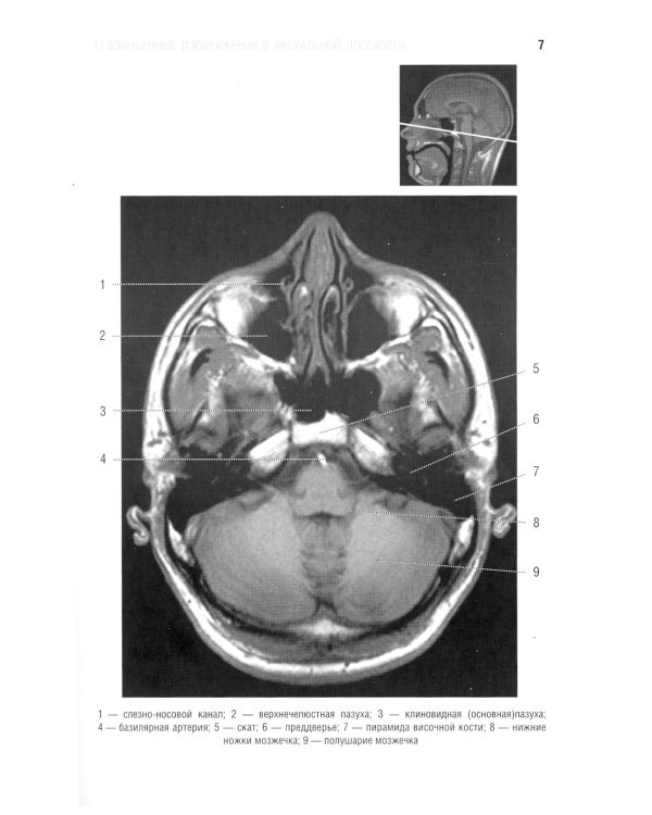 Норма КТ- и МРТ- изображений головного мозга и позвоночника: атлас изображений. 4-е изд