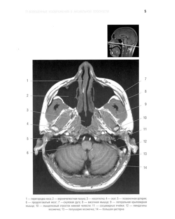 Норма КТ- и МРТ- изображений головного мозга и позвоночника: атлас изображений. 4-е изд
