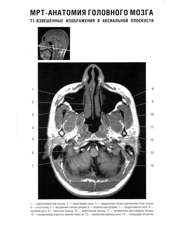 Норма КТ- и МРТ- изображений головного мозга и позвоночника: атлас изображений. 4-е изд