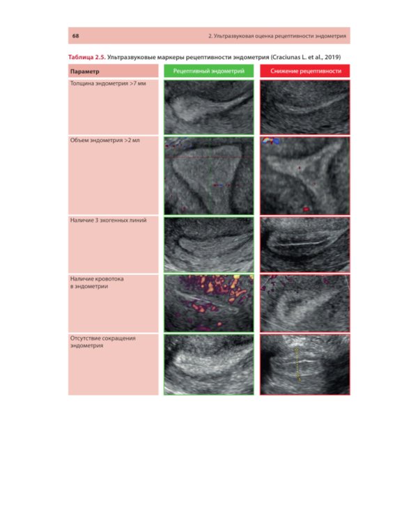 Ультразвуковая оценка рецептивности эндометрия: методические рекомендации