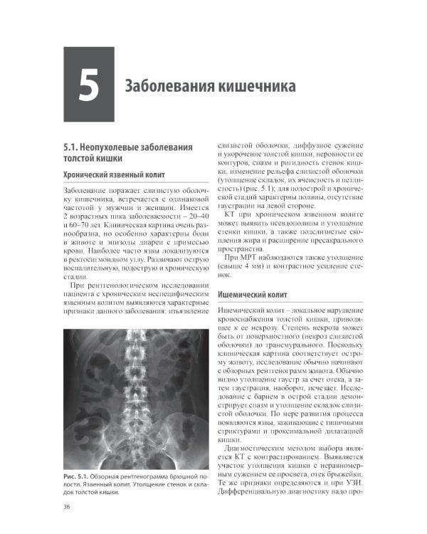 Тазовые боли у женщин. Дифференцианальная диагностика лучевыми методами