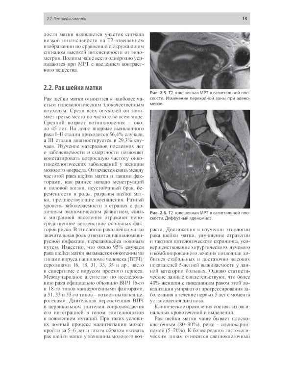 Тазовые боли у женщин. Дифференцианальная диагностика лучевыми методами