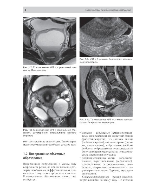 Тазовые боли у женщин. Дифференцианальная диагностика лучевыми методами