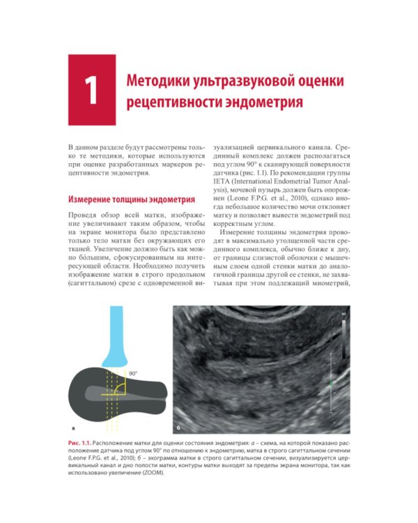 Ультразвуковая оценка рецептивности эндометрия: методические рекомендации