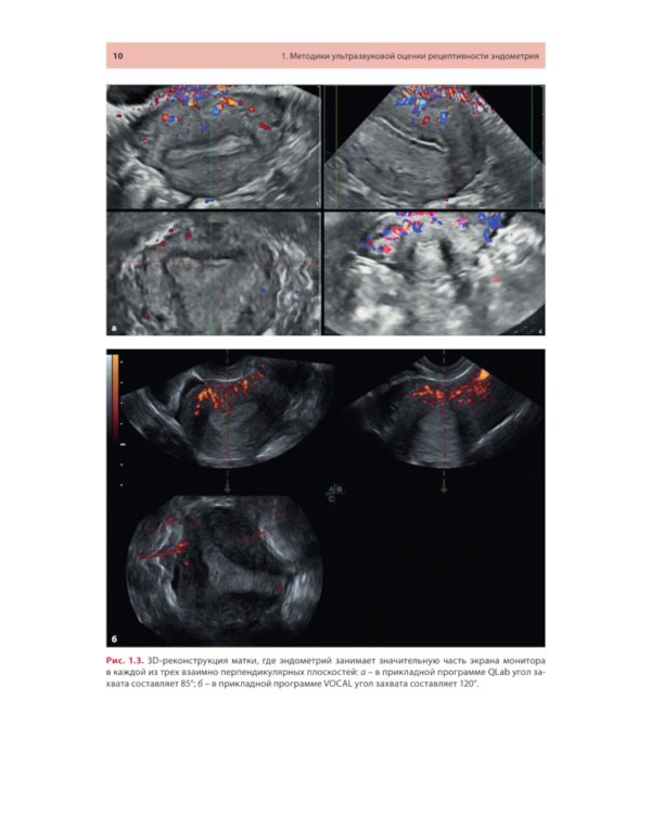 Ультразвуковая оценка рецептивности эндометрия: методические рекомендации