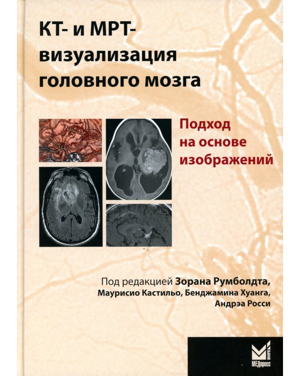 КТ- и МРТ- визуализация головного мозга. Подход на основе изображений. 2-е изд