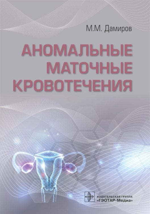Аномальные маточные кровотечения Аномальные маточные кровотечения