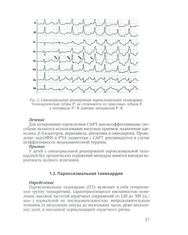 Аритмии сердца у детей и подростков: Учебное пособие