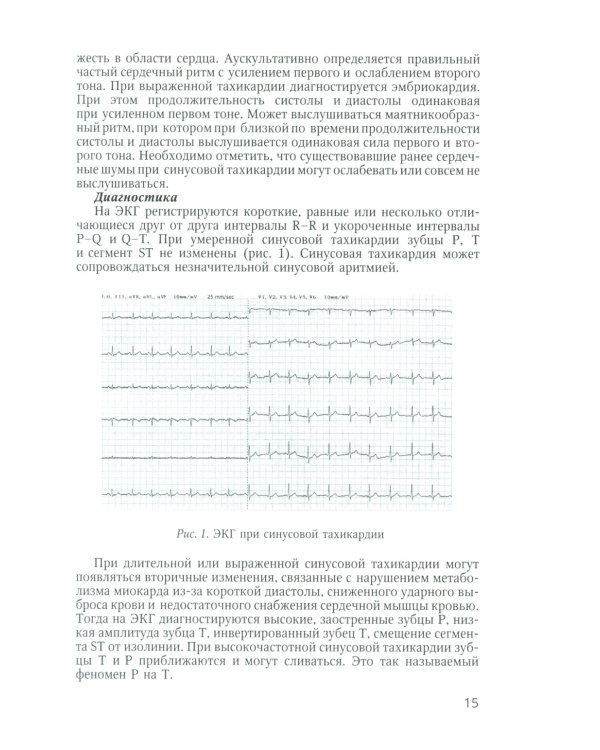 Аритмии сердца у детей и подростков: Учебное пособие