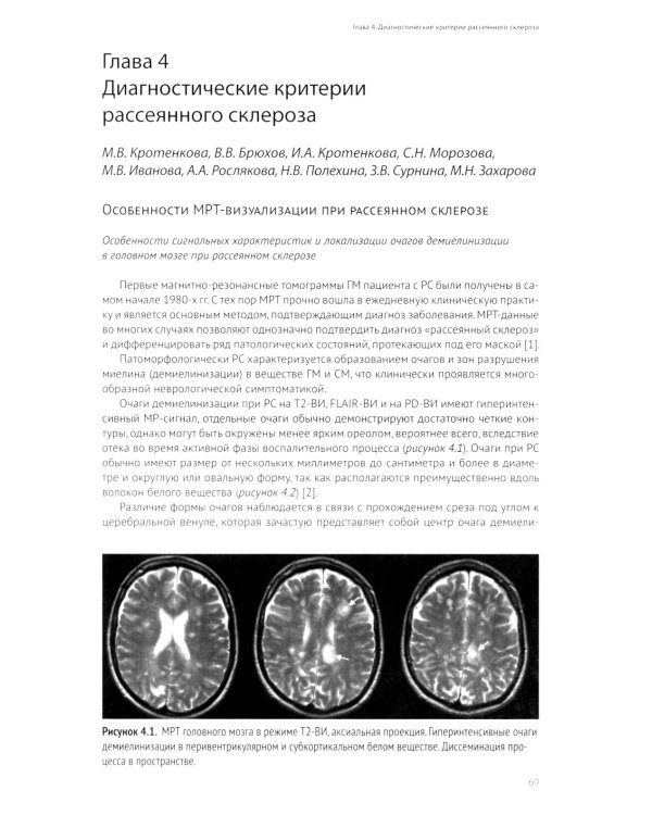 Рассеянный склероз: вопросы диагностики и лечения; Рассеянный склероз в фокусе; Жизнь с рассеянным склерозом. (комплект из 3-х книг)