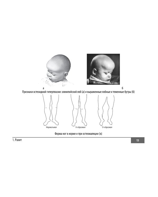 Факультетская педиатрия. Шпаргалки (карм.формат)