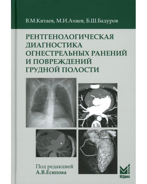 Рентгенологическая диагностика огнестрельных ранений и повреждений грудной полости