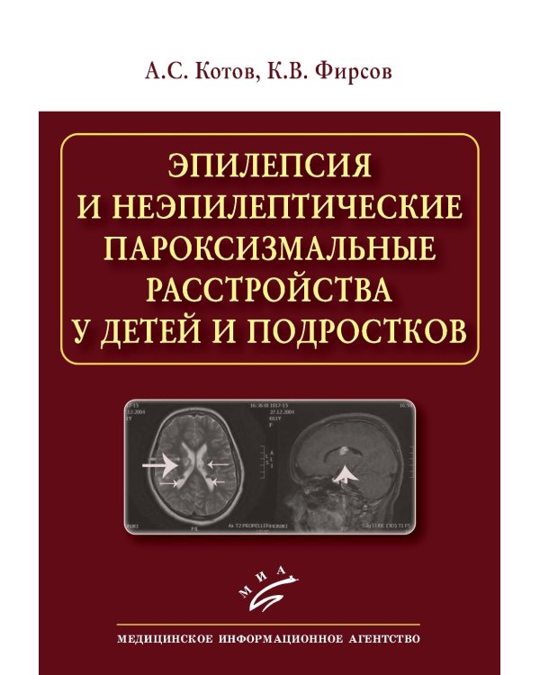 Эпилепсия и неэпилептические пароксизмальные расстройства у детей и подростков