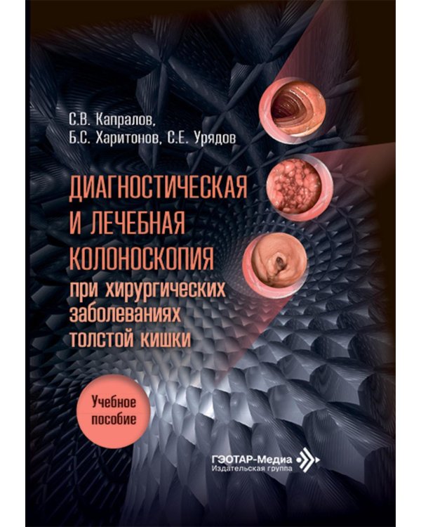 Диагностическая и лечебная колоноскопия при хирургических заболеваниях толстой кишки: Учебное пособие