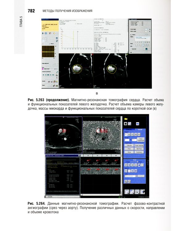Основы лучевой диагностики и терапии: национальное руководство. + CD