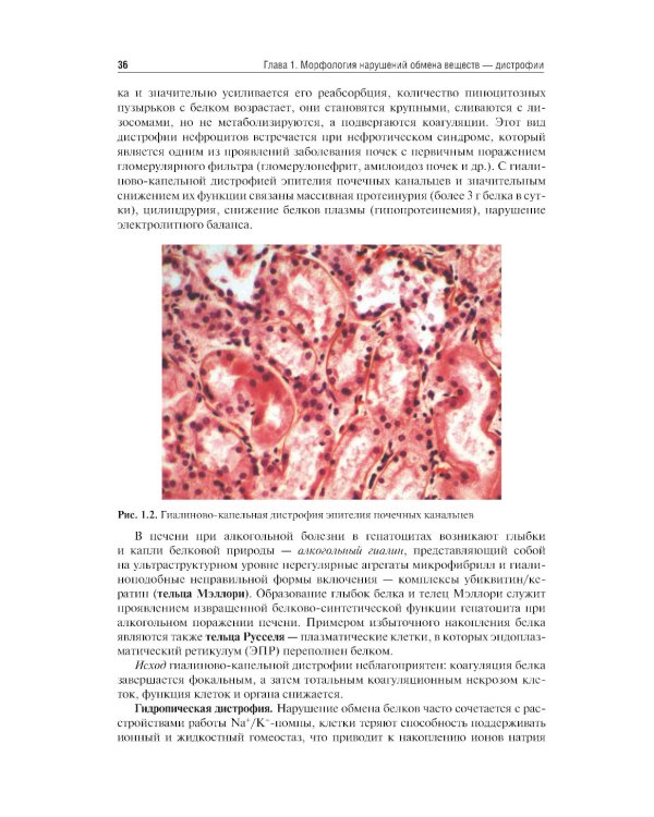 Патологическая анатомия: Учебник: В 2 т.  Т. 1. Общая патология.  3-е изд., перераб