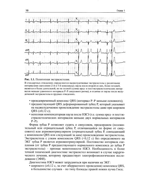 Как лечить аритмии. Диагностика и терапия нарушений ритма и проводимости в клинической практике. 12-е изд., перераб