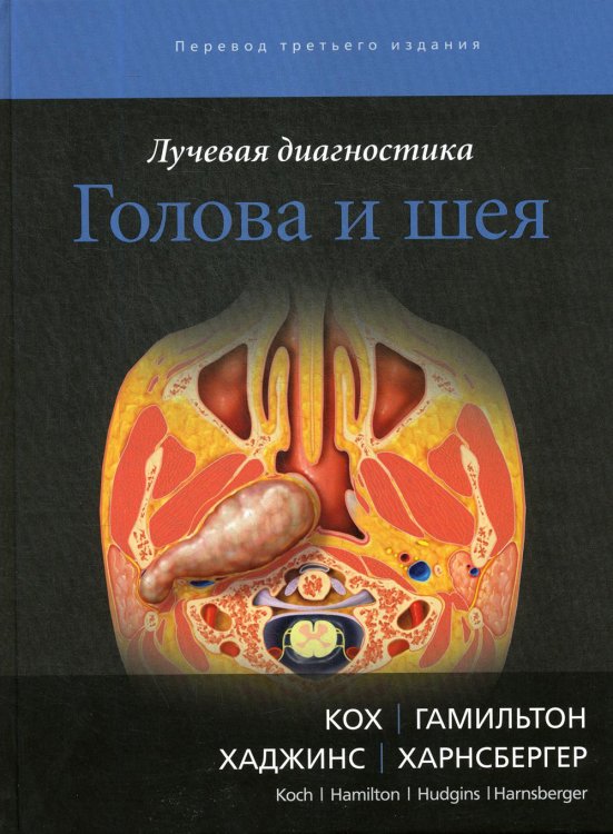 Лучевая диагностика Лучевая диагностика. Голова и шея. 3-е изд