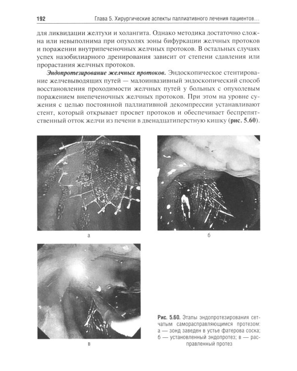 Паллиативная медицинская помощь в онкологии: Учебник. 2-е изд., перераб. и доп