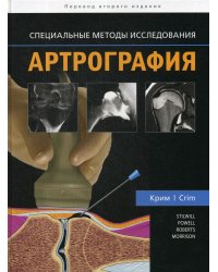 Артрография. Специальные методы исследования