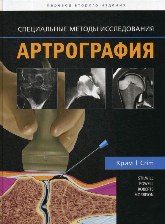 Специальные методы исследования Артрография. Специальные методы исследования