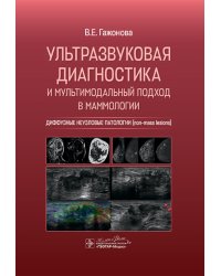 Ультразвуковая диагностика и мультимодальный подход в маммологии. Диффузные неузловые патологии (non-mass lesions)