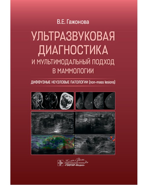 Ультразвуковая диагностика и мультимодальный подход в маммологии. Диффузные неузловые патологии (non-mass lesions)