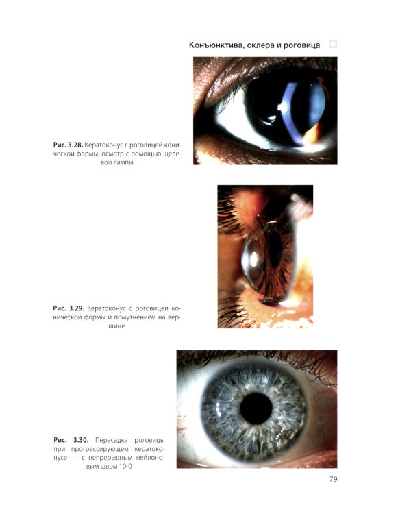 Цветной атлас по офтальмологии