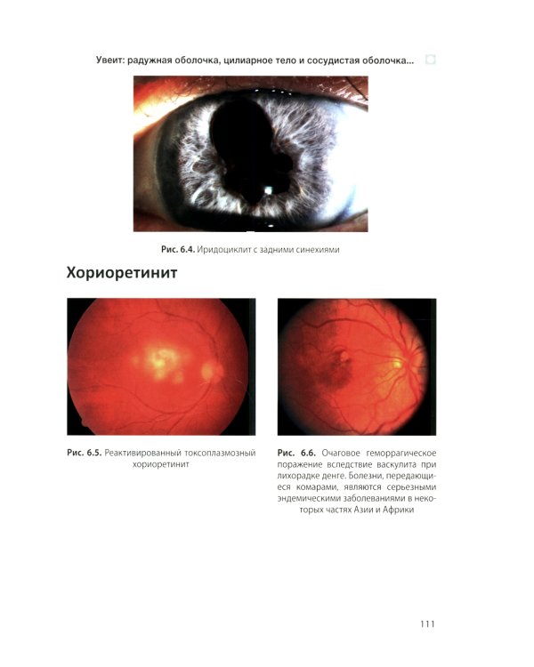 Цветной атлас по офтальмологии