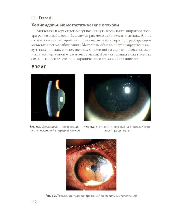 Цветной атлас по офтальмологии