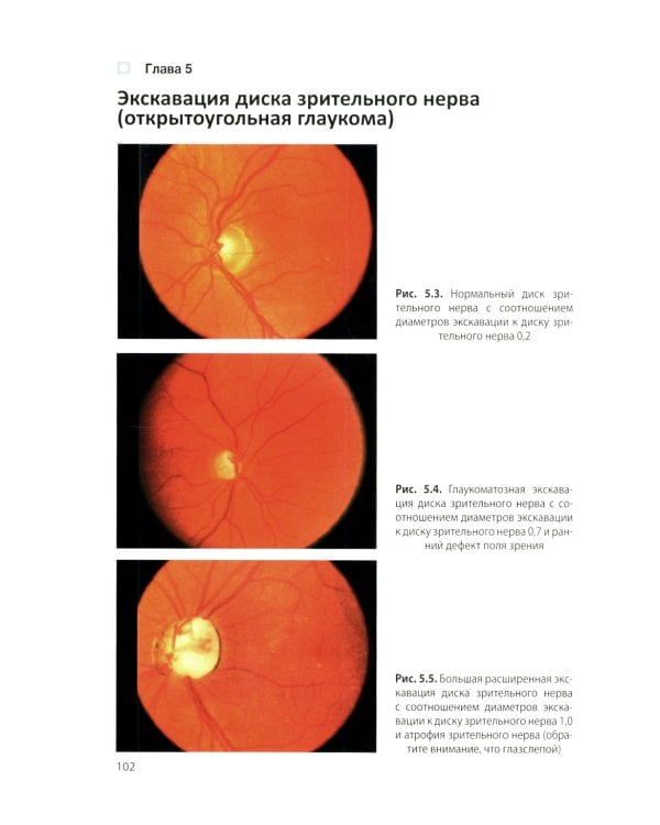 Цветной атлас по офтальмологии