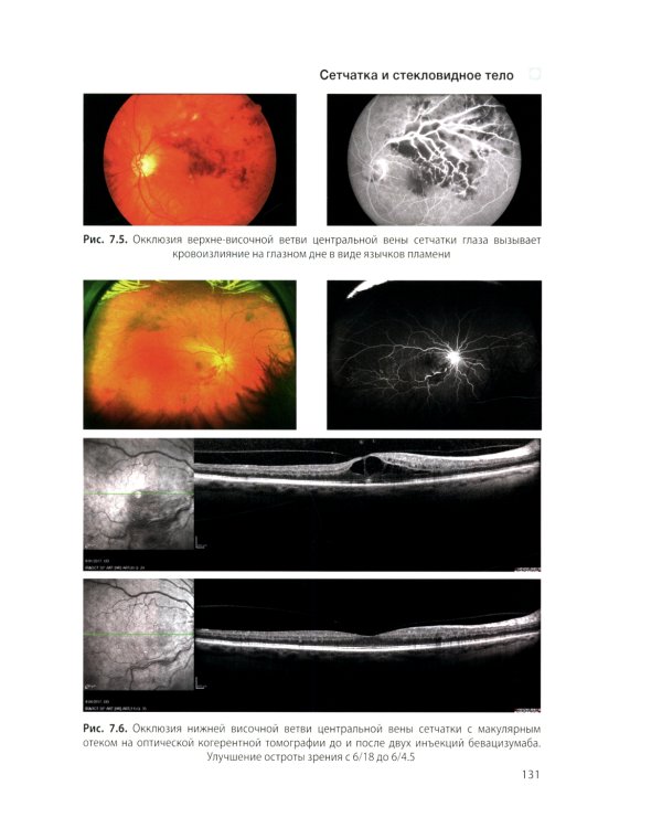 Цветной атлас по офтальмологии