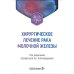 Хирургическое лечение рака молочной железы: Учебное пособие