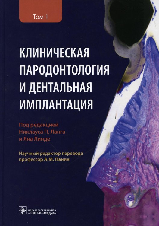 Клиническая пародонтология и дентальная имплантация: В 2-х т. Т. 1 Клиническая пародонтология и дентальная имплантация: В 2-х т. Т. 1