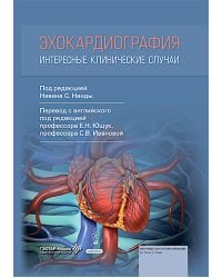 Эхокардиография. Интересные клинические случаи