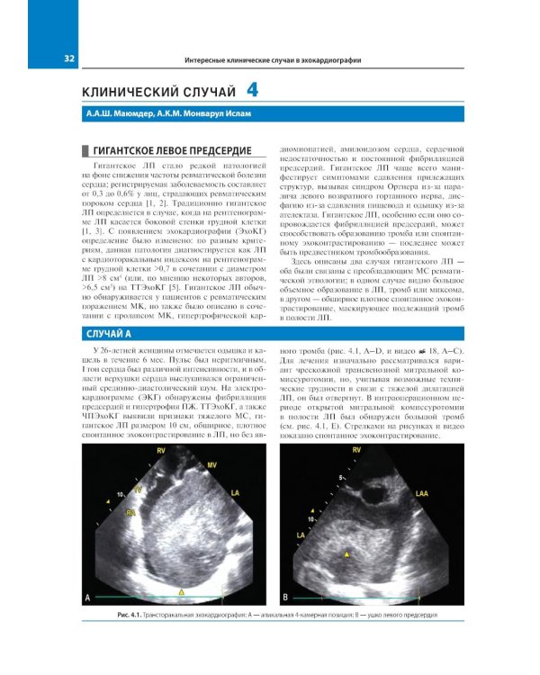 Эхокардиография. Интересные клинические случаи