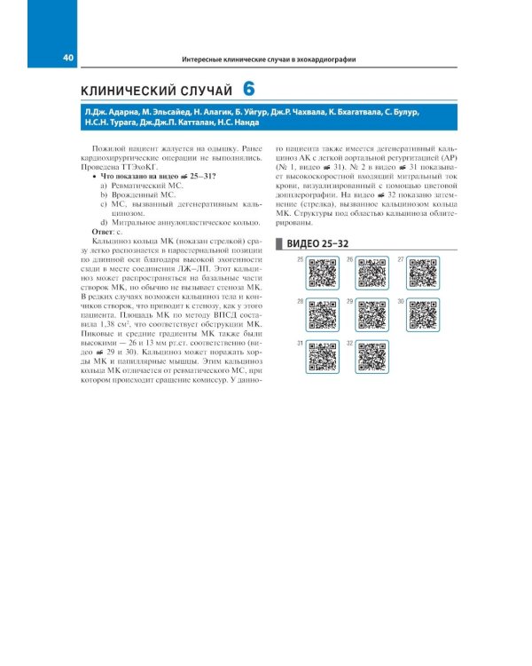 Эхокардиография. Интересные клинические случаи